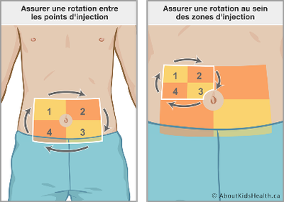 proc-dure-de-soin-injection-sous-cutan-e-0-18-ans-chuv-proc-dure